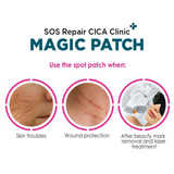 SOS Repair CICA Clinic Magic Acne Patch