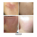 Ceramine Time Solution Cream