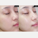 iLomys Renew Derm Nature Mask