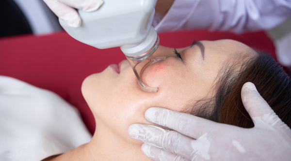 Fractional Laser Treatment Aftercare Do's and Don'ts